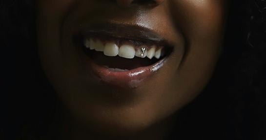 Kosmetische Zahnbehandlung